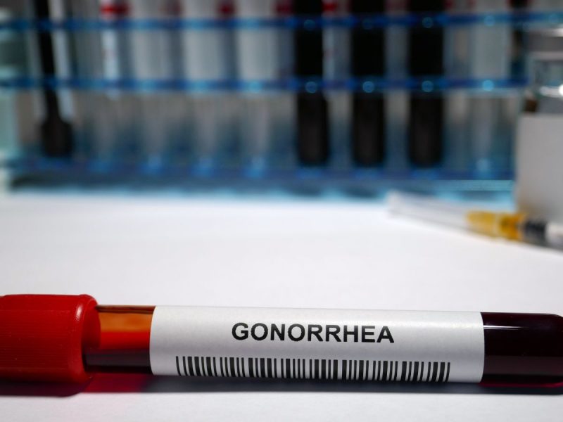 Gonorrhea treatment screening test